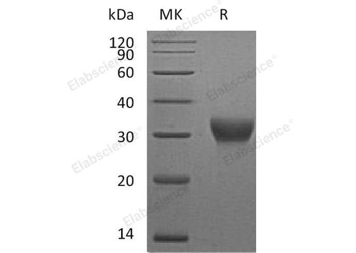 Recombinant Mouse VSIG4 Protein (His Tag) - ABMIUM