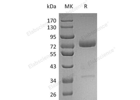 Recombinant Human Mesothelin/MSLN Protein (aa 296-598, Fc Tag) - ABMIUM