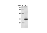 SDS-PAGE analysis of Human PIK3CA proteins, 2 μg/lane of Recombinant Human PIK3CA proteins was resolved with SDS-PAGE under reducing conditions, showing bands at 29 kDa.