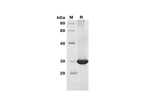 SDS-PAGE analysis of Human PIK3CA proteins, 2 μg/lane of Recombinant Human PIK3CA proteins was resolved with SDS-PAGE under reducing conditions, showing bands at 29 kDa.