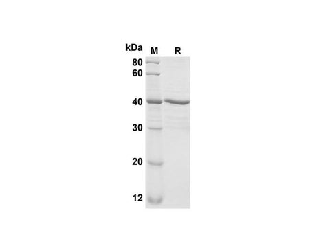 SDS-PAGE analysis of Mouse CXCL1/Lymphotactin1/I-TAC proteins, 2 μg/lane of ReCombinant Mouse CXCL1/Lymphotactin1/I-TAC proteins was resolved with SDS-PAGE under reducing conditions, showing bands at 40 kDa.