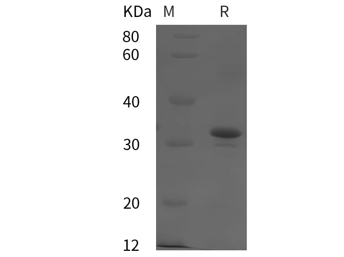SDS-PAGE analysis of Human IDE proteins, 2 μg/lane of Recombinant Human IDE proteins was resolved with SDS-PAGE under reducing conditions, showing bands at 32 kDa.