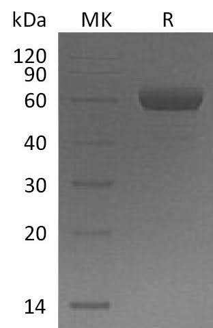 Recombinant Mouse TREM2 Protein (Fc Tag) - ABMIUM