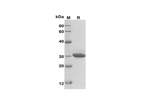 SDS-PAGE analysis of Mouse IL-15 proteins, 2 μg/lane of Recombinant Mouse IL-15 proteins was resolved with SDS-PAGE under reducing conditions, showing bands at 30 kDa.
