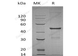 Recombinant Human MBIP Protein (His Tag) - ABMIUM