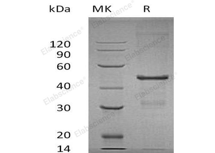 Recombinant Human MBIP Protein (His Tag) - ABMIUM