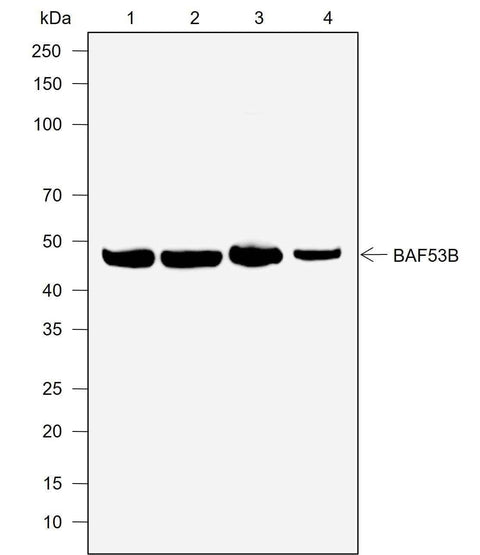 Anti-Human/Rat/Mouse BAF53B Antibody [A760] - ABMIUM