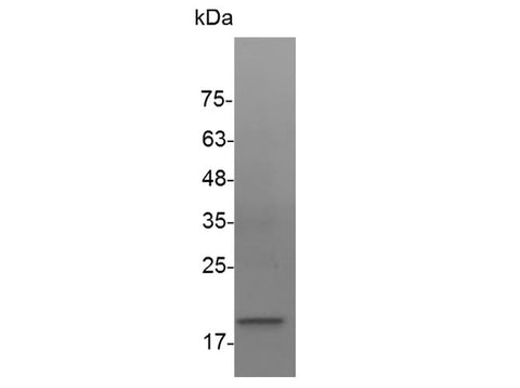 Recombinant Human VEGF-A/VEGF121 Protein - ABMIUM