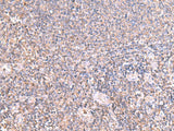 Immunohistochemistry of paraffin-embedded Human tonsil tissue using IFT57 Polyclonal Antibody at dilution of 1:85(×200)
