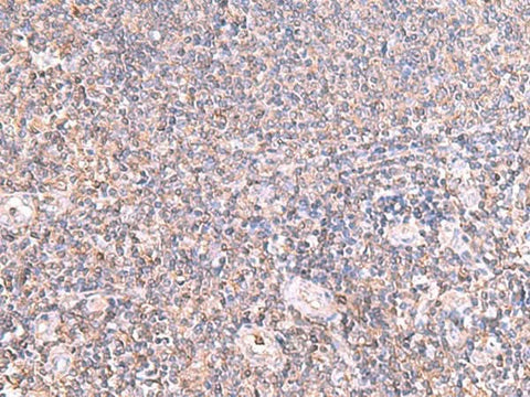 Immunohistochemistry of paraffin-embedded Human tonsil tissue using IFT57 Polyclonal Antibody at dilution of 1:85(×200)