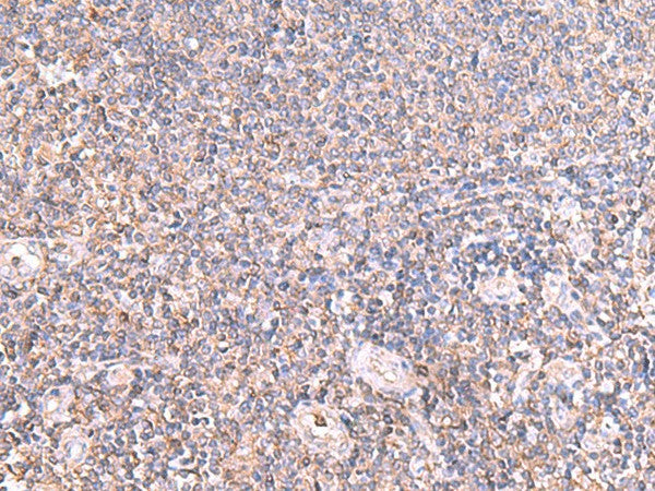 Immunohistochemistry of paraffin-embedded Human tonsil tissue using IFT57 Polyclonal Antibody at dilution of 1:85(×200)