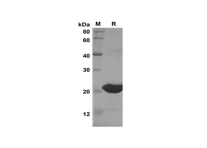 SDS-PAGE analysis of Human ENHO proteins, 2 μg/lane of Recombinant Human ENHO proteins was resolved with SDS-PAGE under reducing conditions, showing bands at 24 kDa.