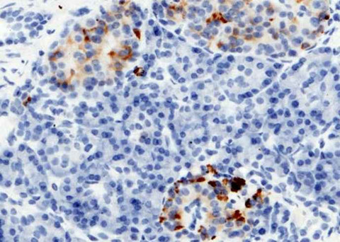 Anti-Human RBP4 Antibody [A861] - ABMIUM