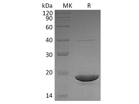 Recombinant Human dUTPase Protein - ABMIUM