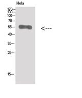 Western Blot analysis of Hela cells using Vimentin Polyclonal Antibody at dilution of 1:500.