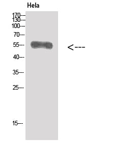 Western Blot analysis of Hela cells using Vimentin Polyclonal Antibody at dilution of 1:500.