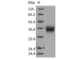 Recombinant Mouse CD8a/Lyt2 Protein (His Tag) - ABMIUM