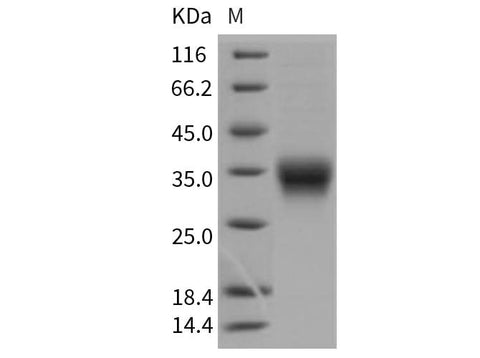 Recombinant Mouse CD8a/Lyt2 Protein (His Tag) - ABMIUM