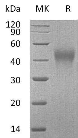 Recombinant Mouse TIM-3/HAVCR2 Protein (aa 20-193, His Tag) - ABMIUM