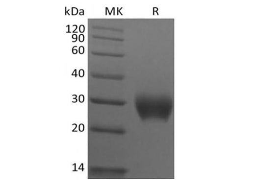 Recombinant Rhesus Macaque Leukocyte-associated Immunoglobulin-like Receptor 1/LAIR1/CD305 (C-6His) - ABMIUM