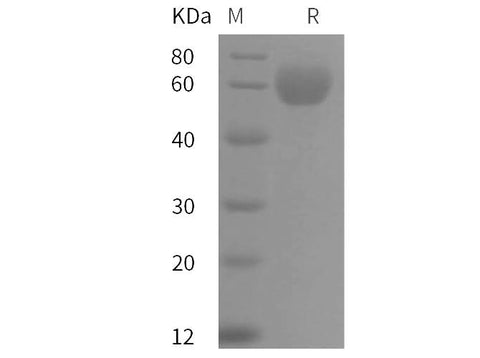 SDS-PAGE analysis of Human ApoH proteins, 2 μg/lane of Recombinant Human ApoH proteins was resolved with SDS-PAGE under reducing conditions, showing bands at 60 kDa.