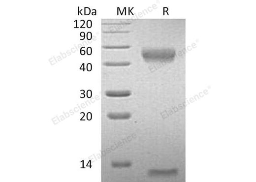 Recombinant Mouse FcRn & B2M Heterodimer Protein (His Tag) - ABMIUM