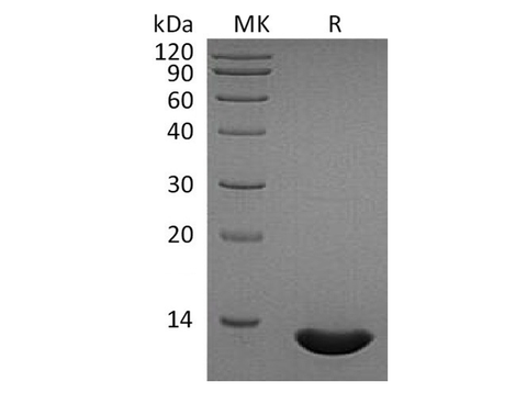 Recombinant Human CCL2/MCP-1 Protein - ABMIUM