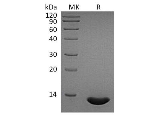 Recombinant Human CCL2/MCP-1 Protein - ABMIUM