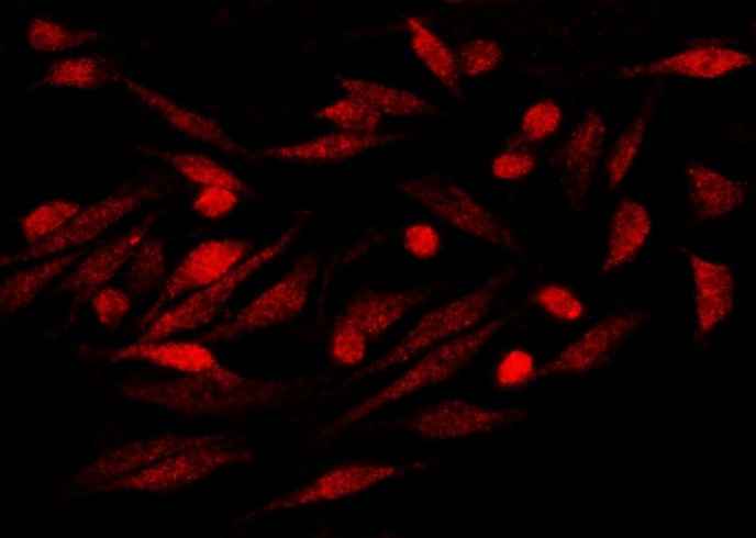 Anti-Human S100P Antibody [A1246] - ABMIUM