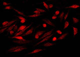 Anti-Human S100P Antibody [A1246] - ABMIUM