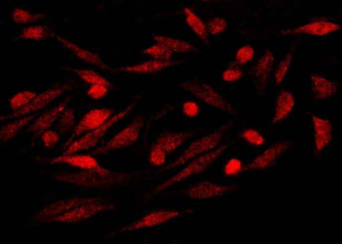 Anti-Human S100P Antibody [A1246] - ABMIUM