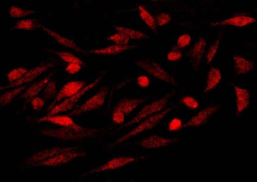 Anti-Human S100P Antibody [A1246] - ABMIUM