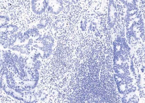 Anti-Human FOXP3 Antibody [A910] - ABMIUM