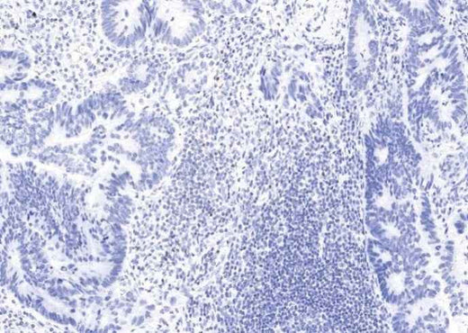Anti-Human FOXP3 Antibody [A910] - ABMIUM