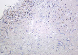 Anti-Human/Mouse/Rat Fos B Antibody [B1035]