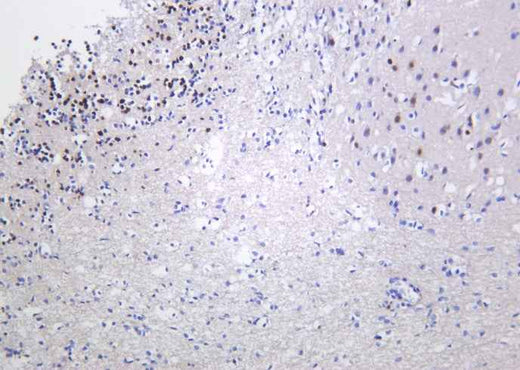 Anti-Human/Mouse/Rat Fos B Antibody [B1035] - ABMIUM