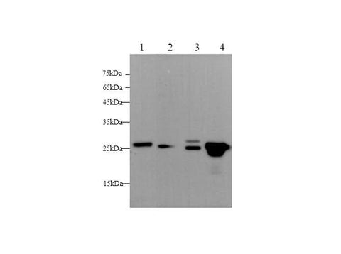 Anti-Human/Mouse/Rat GSTp1 Antibody - ABMIUM