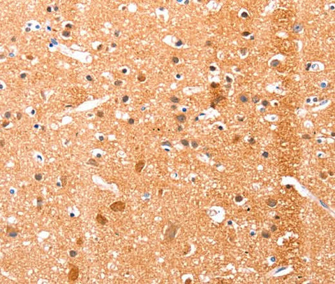 Anti-Human/Mouse/Rat EFNA1 Antibody - ABMIUM