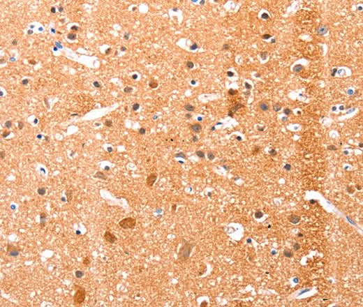 Anti-Human/Mouse/Rat EFNA1 Antibody - ABMIUM