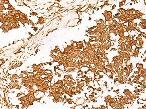 Anti-Human/Mouse HUS1 Antibody