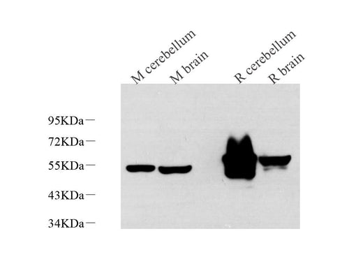 Western Blot analysis of various samples using GFAP Monoclonal Antibody at dilution of 1:1000.