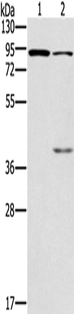 Anti-Human/Mouse CNGA3 Antibody - ABMIUM