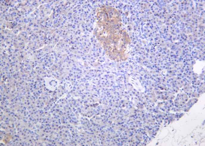 Anti-Human/Mouse/Rat Musashi-1 Antibody [B1006] - ABMIUM