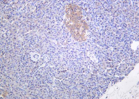 Anti-Human/Mouse/Rat Musashi-1 Antibody [B1006] - ABMIUM
