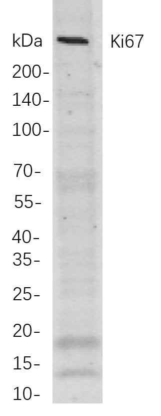 Anti-Human/Mouse/Rat Ki67 Antibody [B829] - ABMIUM