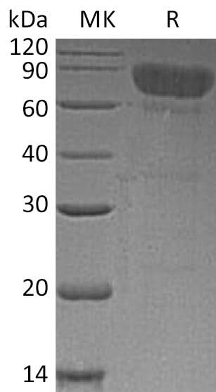 Recombinant Human TCblR/8D6A Protein (Fc Tag) - ABMIUM