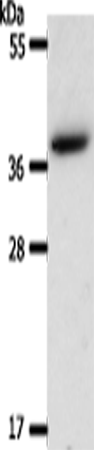 Anti-Human AKR1B1 Antibody - ABMIUM