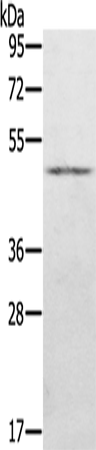 Anti-Human/Mouse/Rat KDM8 Antibody - ABMIUM