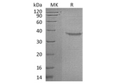 Recombinant Human Somatoliberin/GHRH Protein (Fc Tag) - ABMIUM