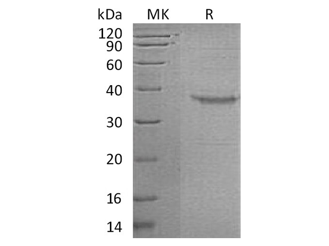Recombinant Human Somatoliberin/GHRH Protein (Fc Tag) - ABMIUM